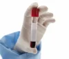 Testemunhas de Jeová flexibilizam regra sobre sangue e reacendem debate médico e religioso